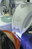 Implante dental